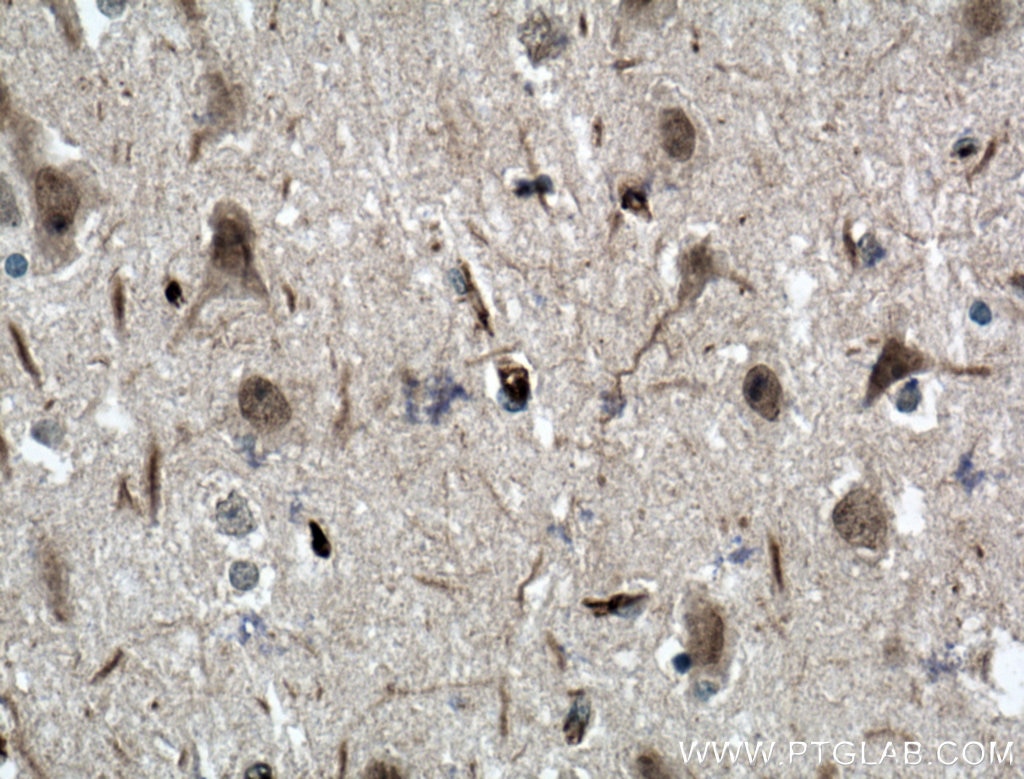 IHC staining of human brain using 21696-1-AP
