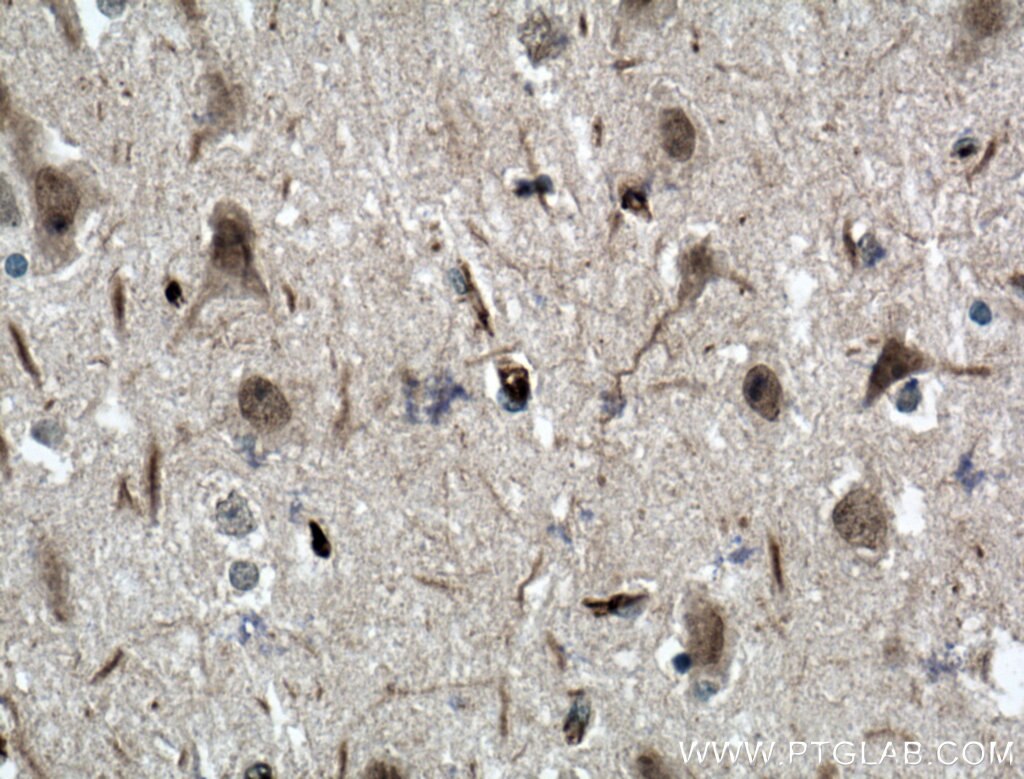 Immunohistochemistry (IHC) staining of human brain tissue using Teneurin 1 Polyclonal antibody (21696-1-AP)