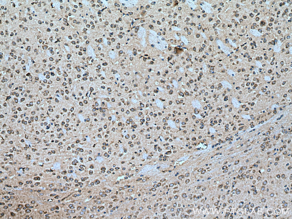 Immunohistochemistry (IHC) staining of mouse brain tissue using Teneurin 1 Polyclonal antibody (21696-1-AP)