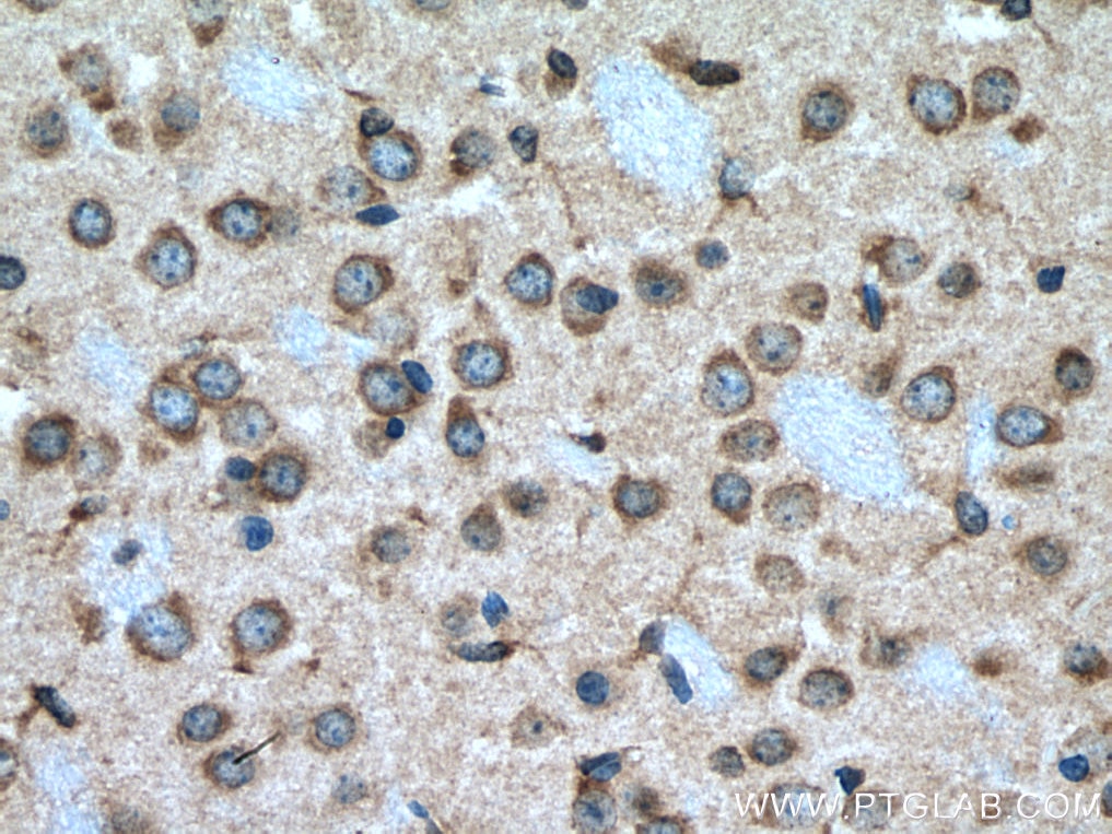 Immunohistochemistry (IHC) staining of mouse brain tissue using Teneurin 1 Polyclonal antibody (21696-1-AP)