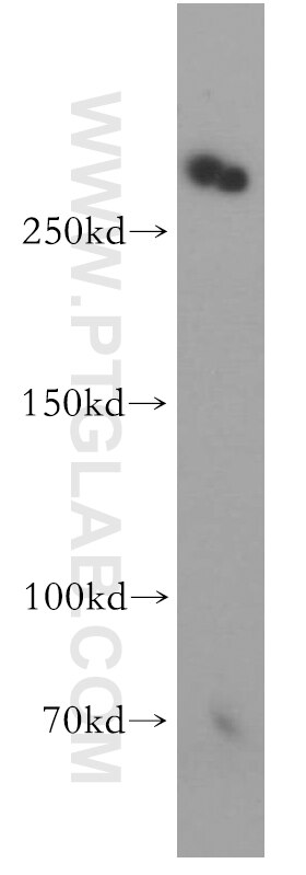 Western Blot (WB) analysis of human brain tissue using Teneurin 1 Polyclonal antibody (21696-1-AP)