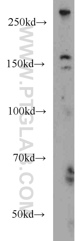 Western Blot (WB) analysis of mouse brain tissue using Teneurin 1 Polyclonal antibody (21696-1-AP)