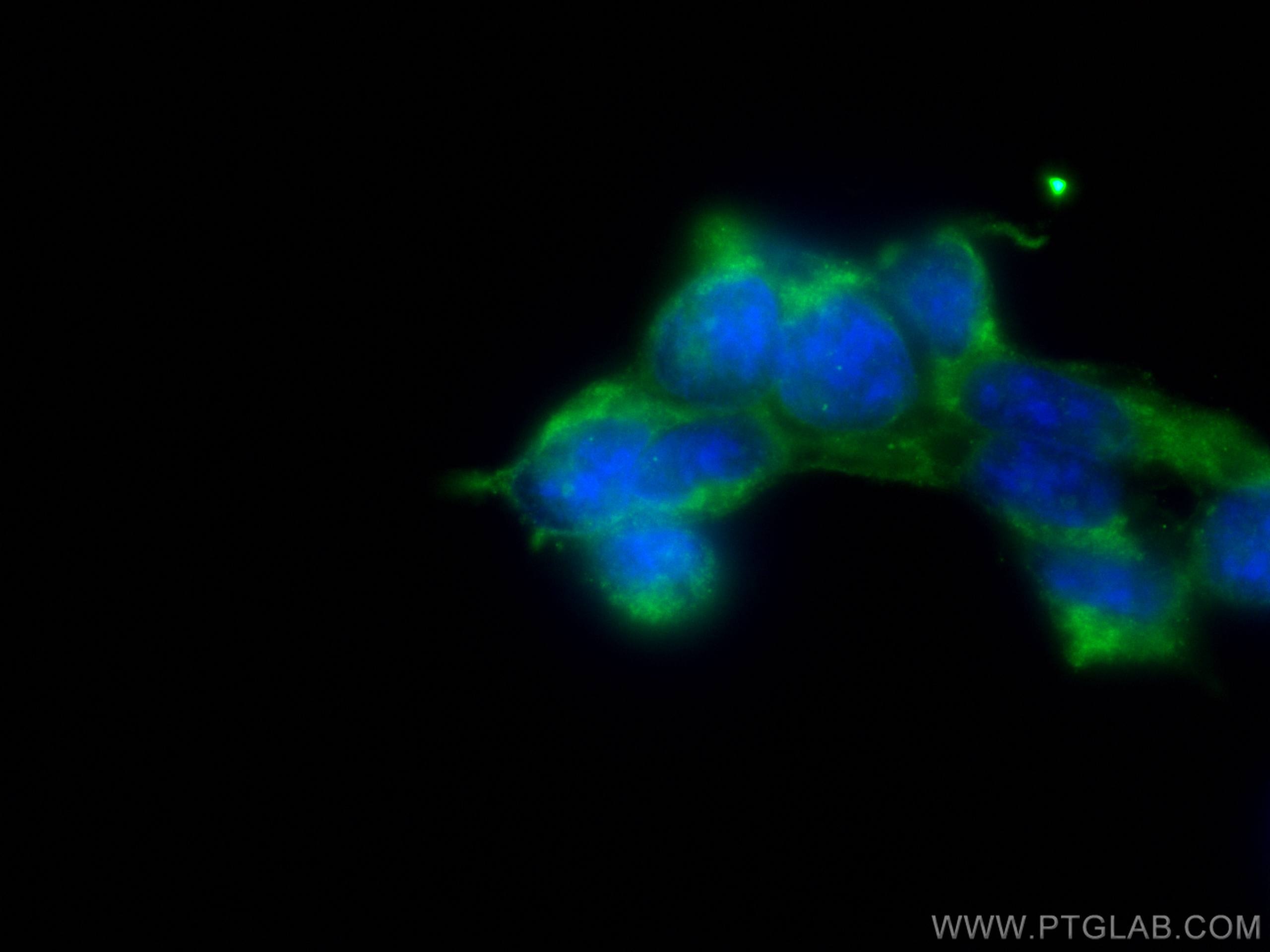 Immunofluorescence (IF) / fluorescent staining of HEK-293 cells using OFD1 Polyclonal antibody (22851-1-AP)