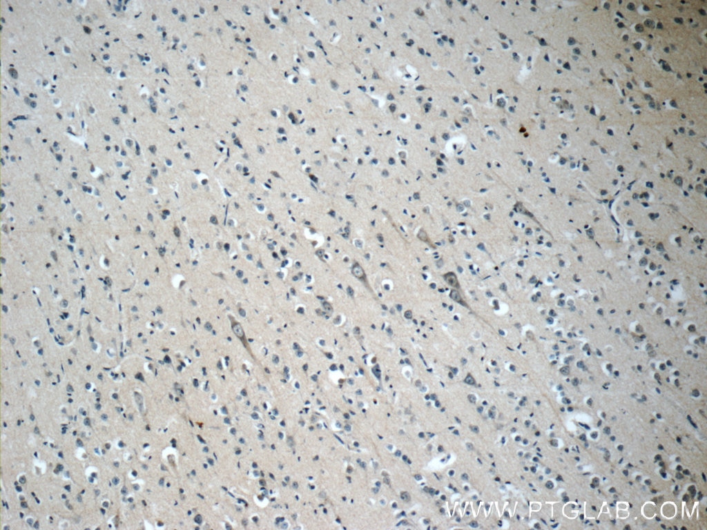 Immunohistochemistry (IHC) staining of human brain tissue using OFD1 Polyclonal antibody (22851-1-AP)