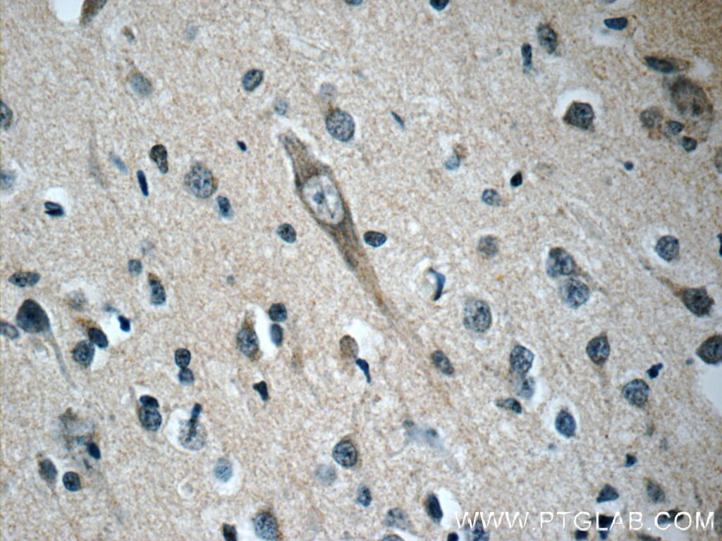 Immunohistochemistry (IHC) staining of human brain tissue using OFD1 Polyclonal antibody (22851-1-AP)