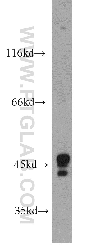 Western Blot (WB) analysis of HeLa cells using OFD1 Polyclonal antibody (22851-1-AP)
