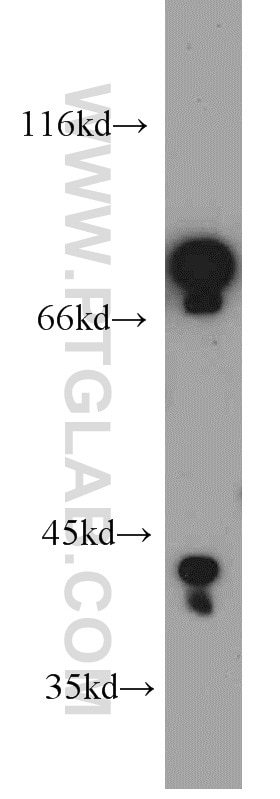 Western Blot (WB) analysis of SH-SY5Y cells using OFD1 Polyclonal antibody (22851-1-AP)