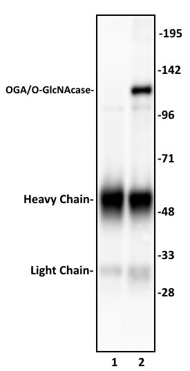 OGA/O-GlcNAcase antibody (pAb) tested by Immunoprecipitation. 10 ul of OGA/O-GlcNAcase antibody was used to immunoprecipitate OGA/O-GlcNAcase from 400 ug of HeLa whole cell extract (lane 2). 10 ul of rabbit IgG was used as a negative control (lane 1). The immunoprecipitated protein was detected by Western blotting using the OGA/O-GlcNAcase antibody at a dilution of 1:1,000. OGA/O-GlcNAcase antibody (pAb) tested by Immunoprecipitation. 10 ul of OGA/O-GlcNAcase antibody was used to immunoprecipitate OGA/O-GlcNAcase from 400 ug of HeLa whole cell extract (lane 2). 10 ul of rabbit IgG was used as a negative control (lane 1). The immunoprecipitated protein was detected by Western blotting using the OGA/O-GlcNAcase antibody at a dilution of 1:1,000.