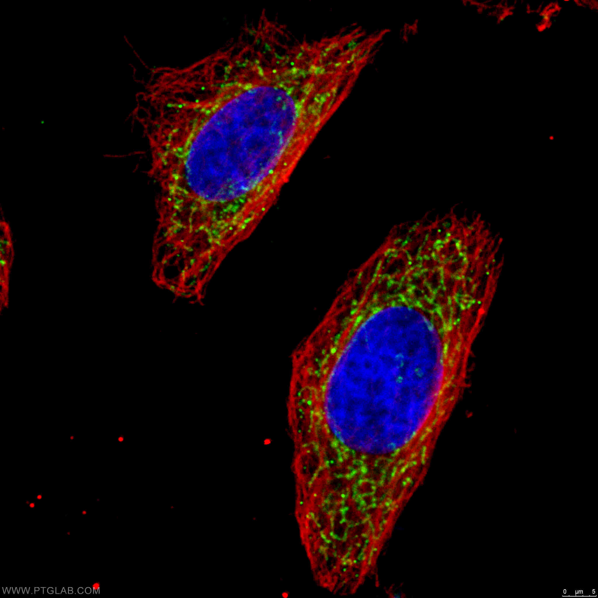 Immunofluorescence (IF) / fluorescent staining of HeLa cells using OGDH Polyclonal antibody (15212-1-AP)