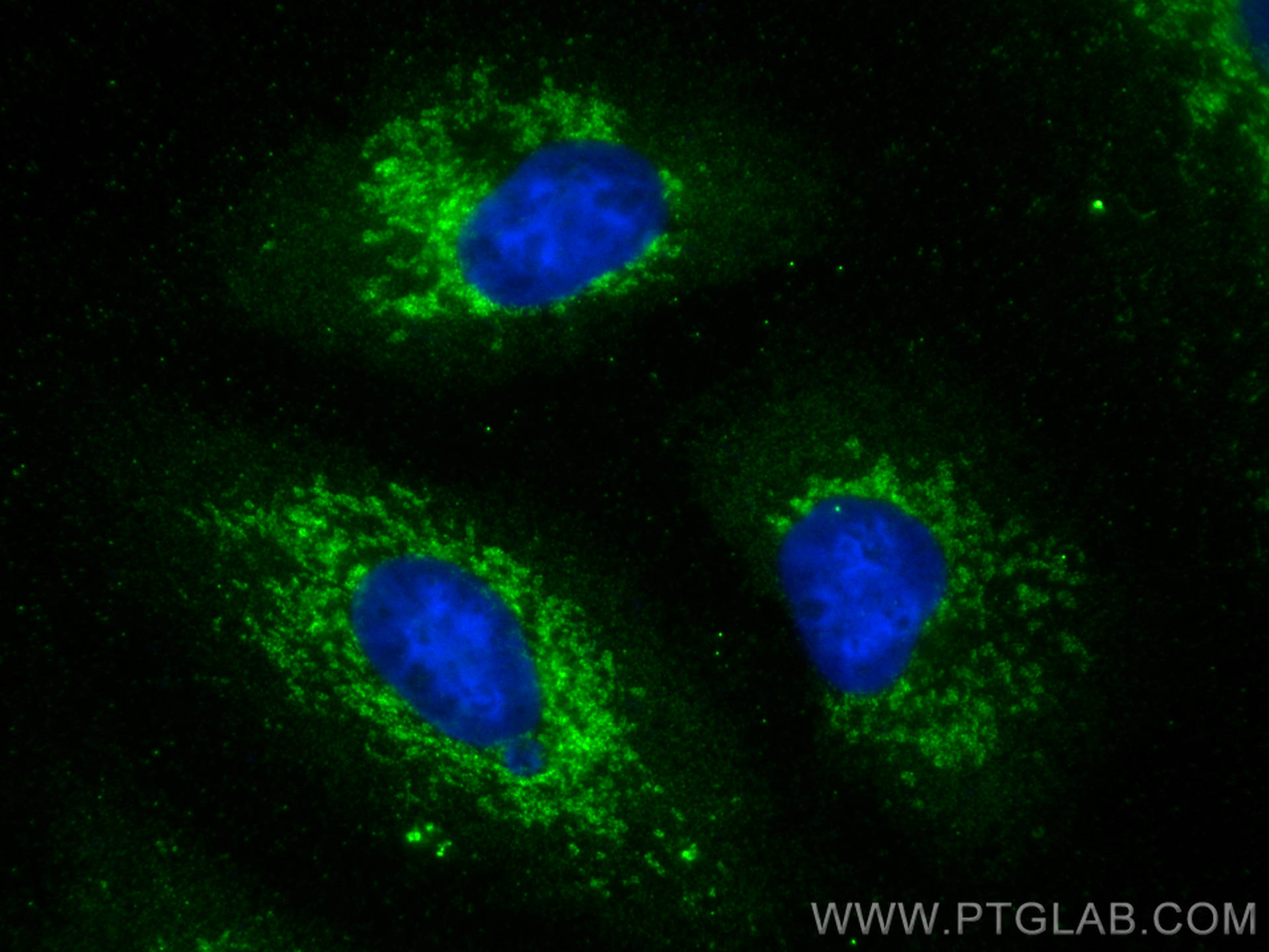 Immunofluorescence (IF) / fluorescent staining of A549 cells using OGDH Polyclonal antibody (15212-1-AP)