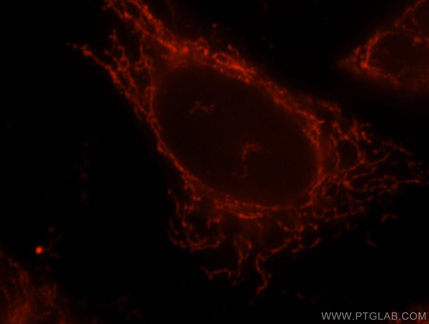 Immunofluorescence (IF) / fluorescent staining of HeLa cells using OGDH Polyclonal antibody (15212-1-AP)