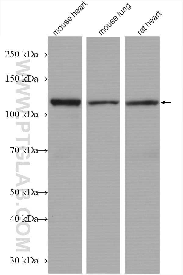 Western Blot (WB) analysis of various lysates using OGDH Polyclonal antibody (15212-1-AP)
