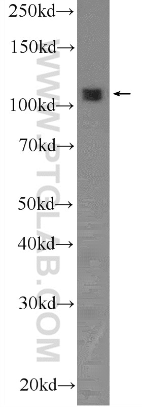 WB analysis of ROS1728 using 15212-1-AP