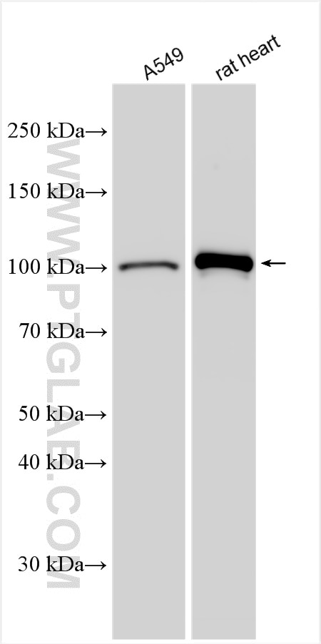 Western Blot (WB) analysis of various lysates using OGDH Polyclonal antibody (15212-1-AP)