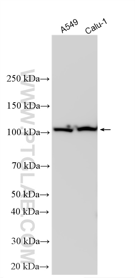 Various lysates were subjected to SDS PAGE followed by western blot with 15212-1-AP (OGDH antibody) at dilution of 1:30000 incubated at room temperature for 1.5 hours. Western Blot (WB) analysis of various lysates using OGDH Polyclonal antibody (15212-1-AP)