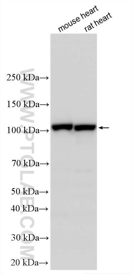 Various lysates were subjected to SDS PAGE followed by western blot with 15212-1-AP (OGDH antibody) at dilution of 1:30000 incubated at room temperature for 1.5 hours. Western Blot (WB) analysis of various lysates using OGDH Polyclonal antibody (15212-1-AP)