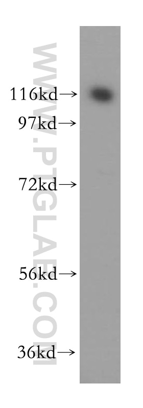 Western Blot (WB) analysis of mouse liver tissue using OGDH Polyclonal antibody (15212-1-AP)