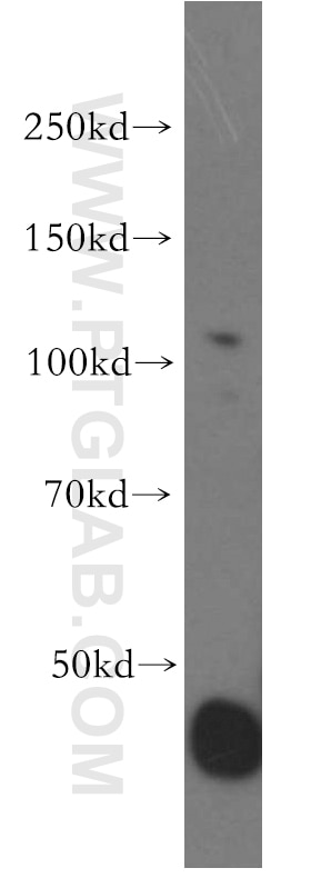 Western Blot (WB) analysis of mouse pancreas tissue using OGDH Polyclonal antibody (15212-1-AP)