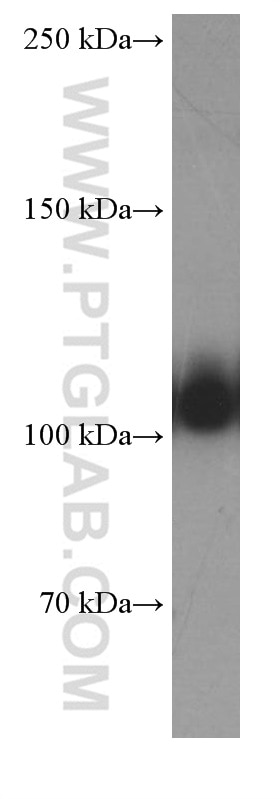 Western Blot (WB) analysis of human heart tissue using OGDH Monoclonal antibody (66285-1-Ig)