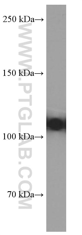 Western Blot (WB) analysis of ROS1728 cells using OGDH Monoclonal antibody (66285-1-Ig)