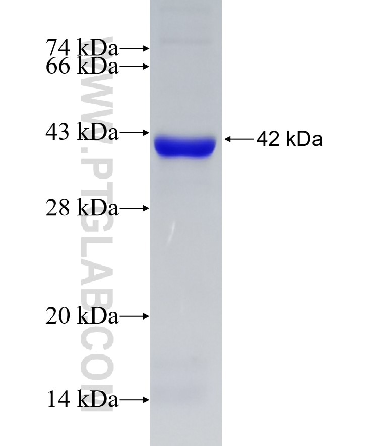 OGDH fusion protein Ag7484 SDS-PAGE