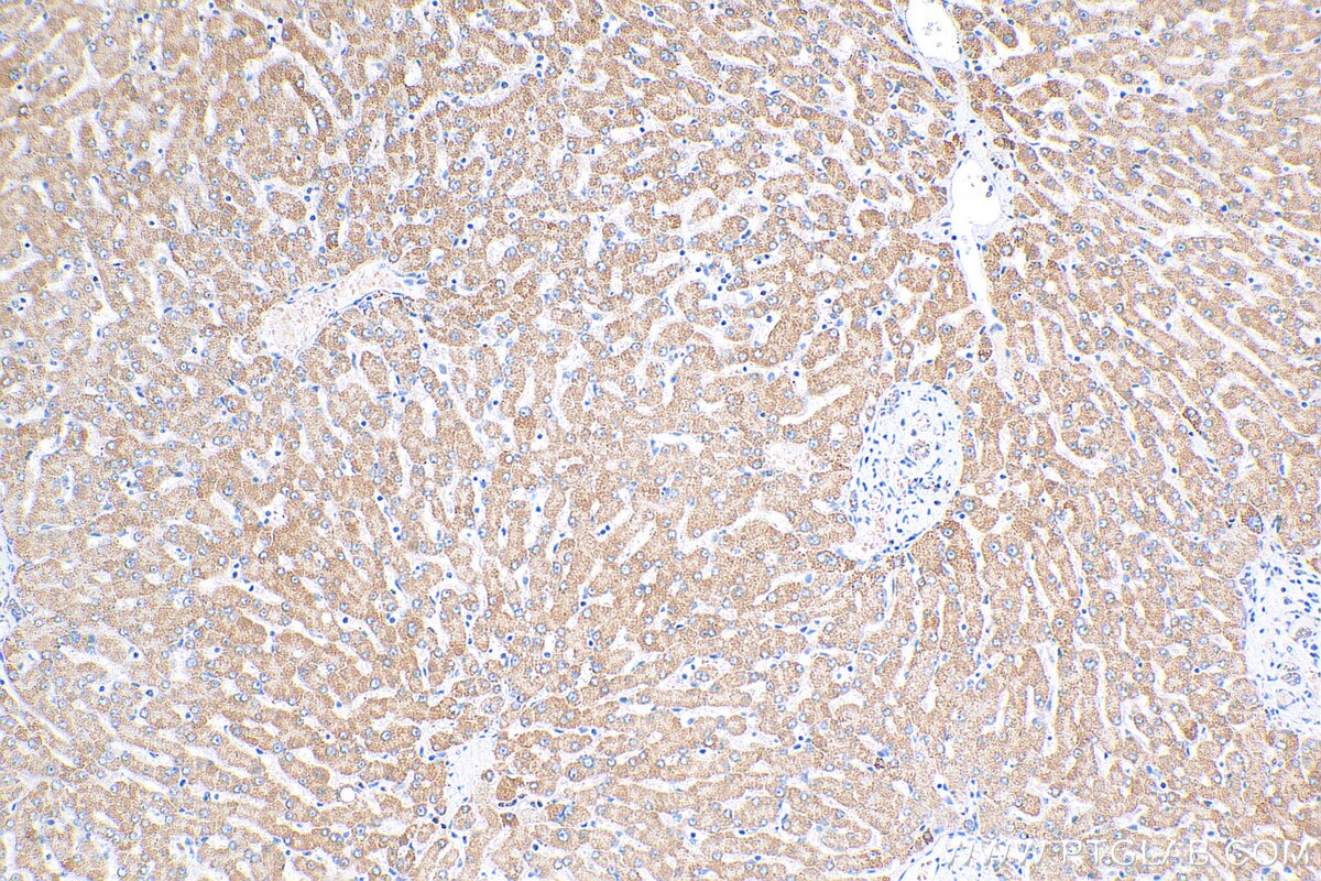 Immunohistochemistry (IHC) staining of human liver tissue using OGDHL Polyclonal antibody (17110-1-AP)