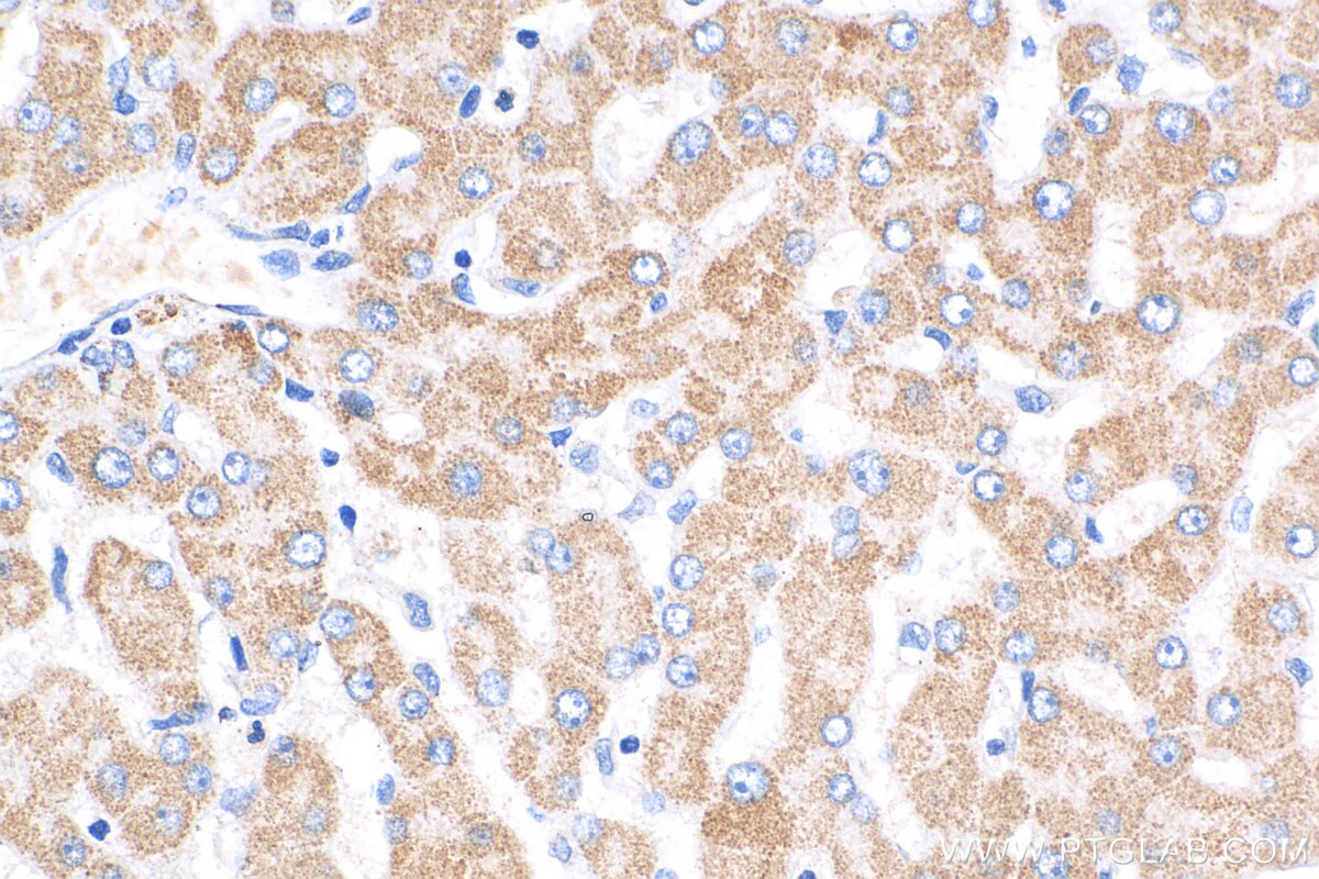 Immunohistochemistry (IHC) staining of human liver tissue using OGDHL Polyclonal antibody (17110-1-AP)