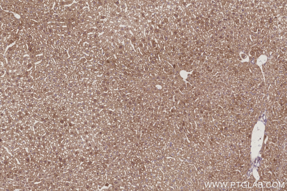 Immunohistochemistry (IHC) staining of mouse liver tissue using OGDHL Polyclonal antibody (17110-1-AP)
