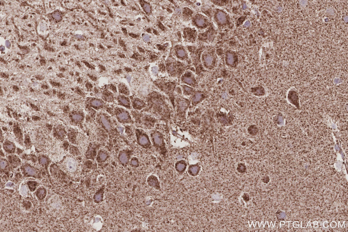 Immunohistochemistry (IHC) staining of rat brain tissue using OGDHL Polyclonal antibody (17110-1-AP)