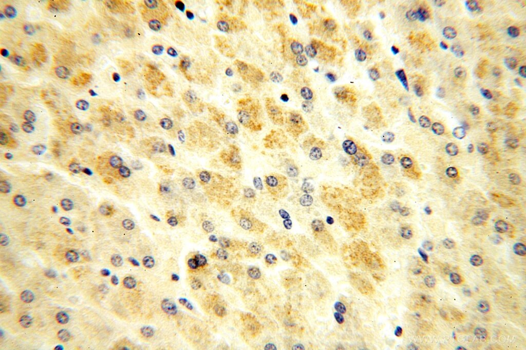 Immunohistochemistry (IHC) staining of human brain tissue using OGDHL Polyclonal antibody (17110-1-AP)