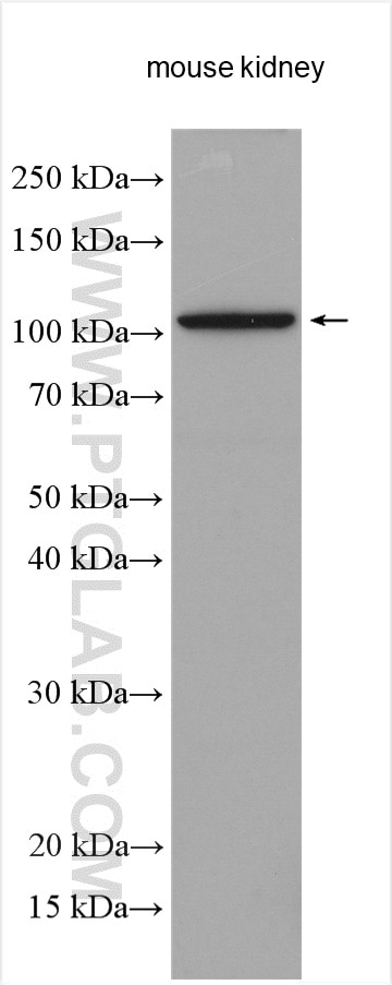 Western Blot (WB) analysis of various lysates using OGDHL Polyclonal antibody (17110-1-AP)