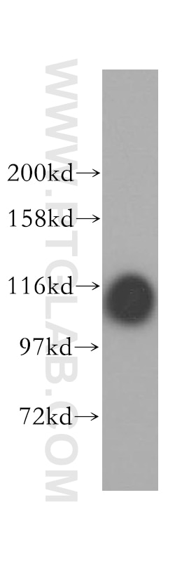 Western Blot (WB) analysis of mouse brain tissue using OGDHL Polyclonal antibody (17110-1-AP)