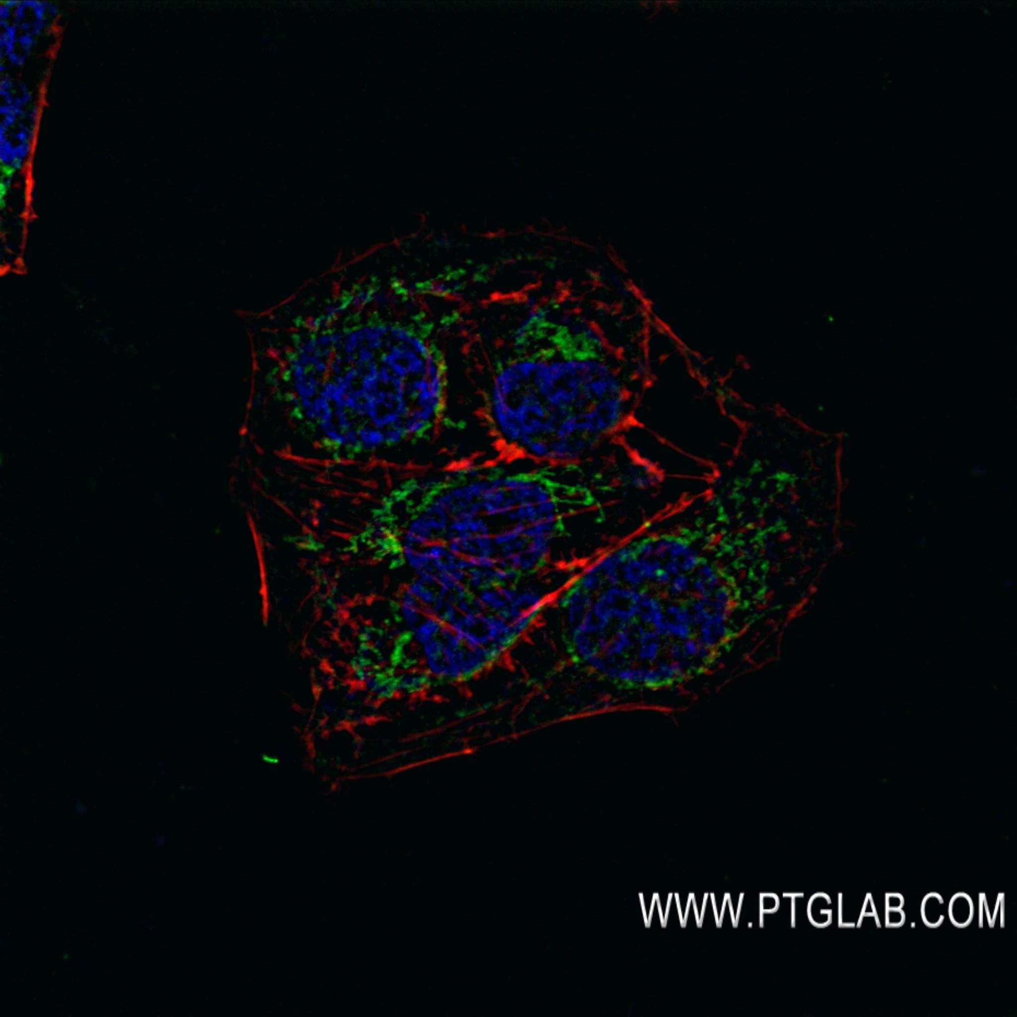 IF Staining of U2OS using 82981-1-RR