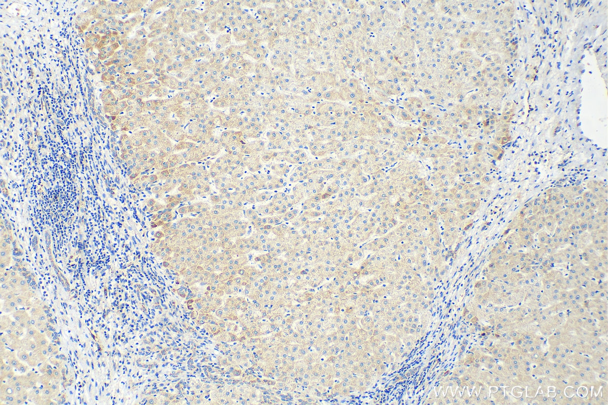 Immunohistochemistry (IHC) staining of human liver tissue using OGDHL Recombinant antibody (82981-1-RR)