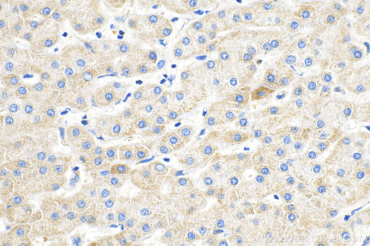 Immunohistochemistry (IHC) staining of human liver tissue using OGDHL Recombinant antibody (82981-1-RR)