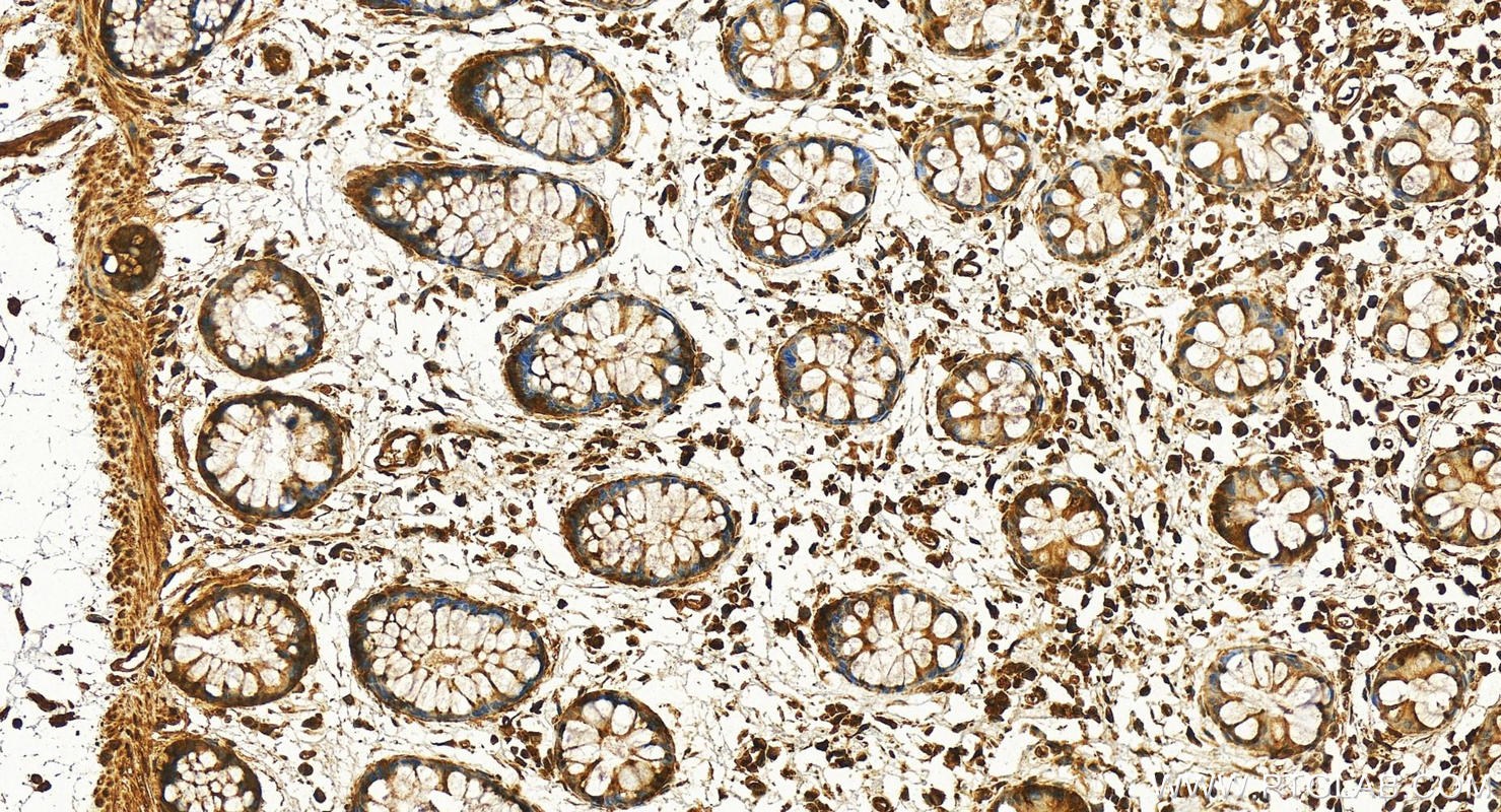 Immunohistochemical analysis of paraffin-embedded human colon tissue slide using 30800-1-AP (OGFOD1 antibody) at dilution of 1:200 (under 20x lens). Heat mediated antigen retrieval with Tris-EDTA buffer (pH 9.0). Immunohistochemistry (IHC) staining of human colon tissue using OGFOD1 Polyclonal antibody (30800-1-AP)