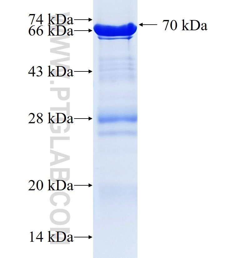 OGFOD1 fusion protein Ag34034 SDS-PAGE