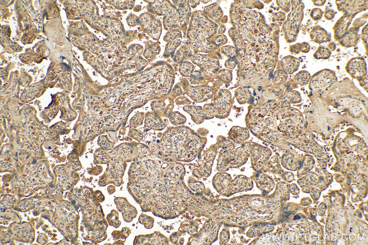 Immunohistochemistry (IHC) staining of human placenta tissue using OGFOD2 Polyclonal antibody (21590-1-AP)