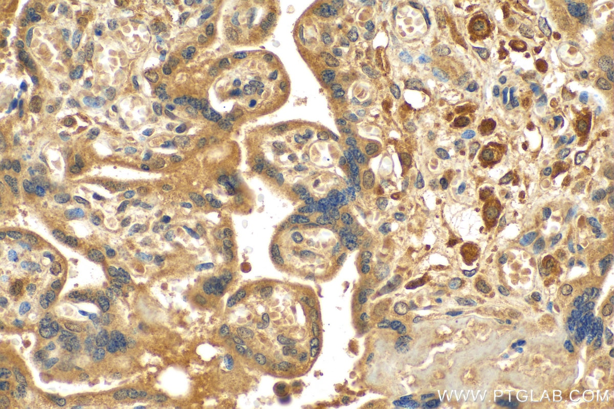 Immunohistochemistry (IHC) staining of human placenta tissue using OGFOD2 Polyclonal antibody (21590-1-AP)