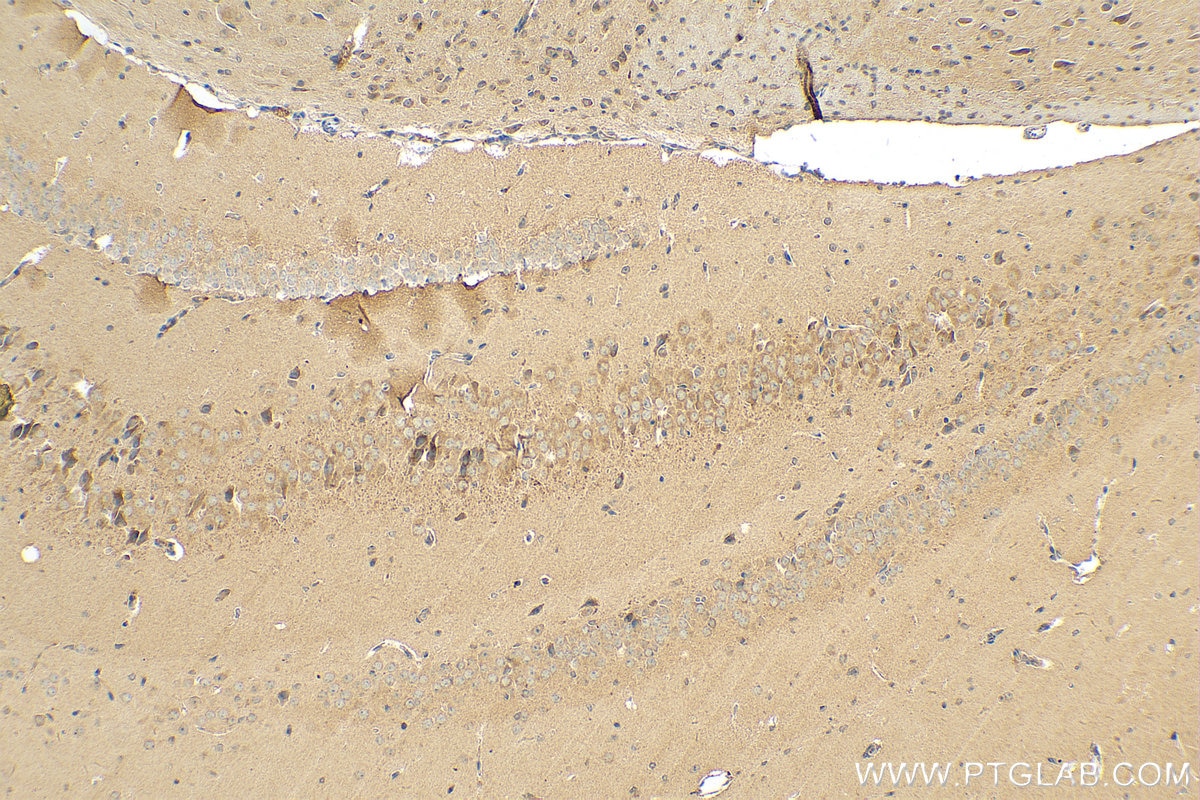 Immunohistochemistry (IHC) staining of mouse brain tissue using OGFOD2 Polyclonal antibody (21590-1-AP)