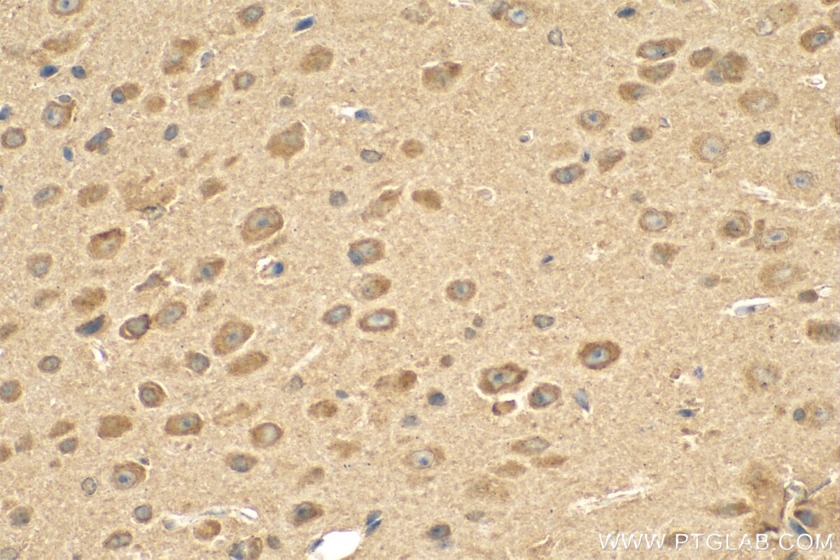 Immunohistochemistry (IHC) staining of mouse brain tissue using OGFOD2 Polyclonal antibody (21590-1-AP)