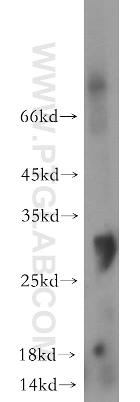 Western Blot (WB) analysis of human testis tissue using OGFOD2 Polyclonal antibody (21590-1-AP)