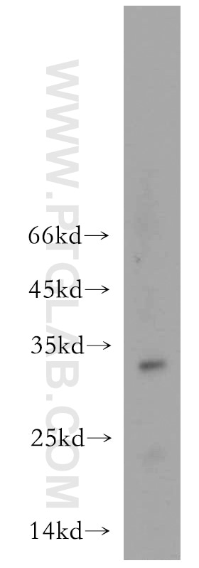 Western Blot (WB) analysis of human skeletal muscle tissue using OGFOD2 Polyclonal antibody (21590-1-AP)