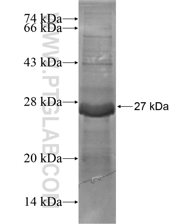OGFOD2 fusion protein Ag17056 SDS-PAGE