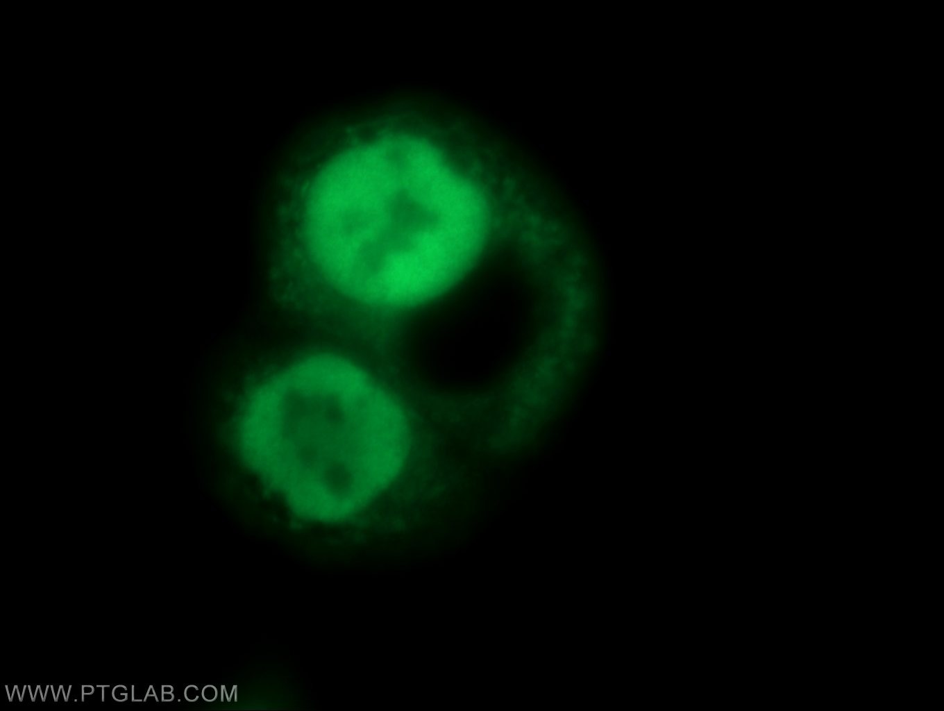 Immunofluorescence (IF) / fluorescent staining of COLO 320 cells using OGFR Polyclonal antibody (11177-1-AP)
