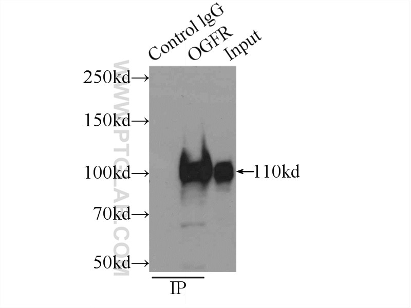 Immunoprecipitation (IP) experiment of COLO 320 cells using OGFR Polyclonal antibody (11177-1-AP)