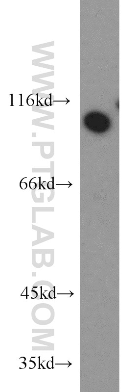 Western Blot (WB) analysis of HEK-293 cells using OGFR Polyclonal antibody (11177-1-AP)