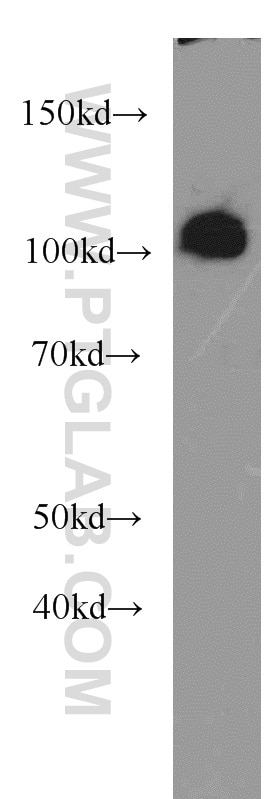 Western Blot (WB) analysis of COLO 320 cells using OGFR Polyclonal antibody (11177-1-AP)