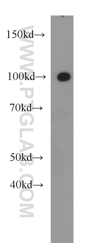 Western Blot (WB) analysis of A549 cells using OGFR Polyclonal antibody (11177-1-AP)