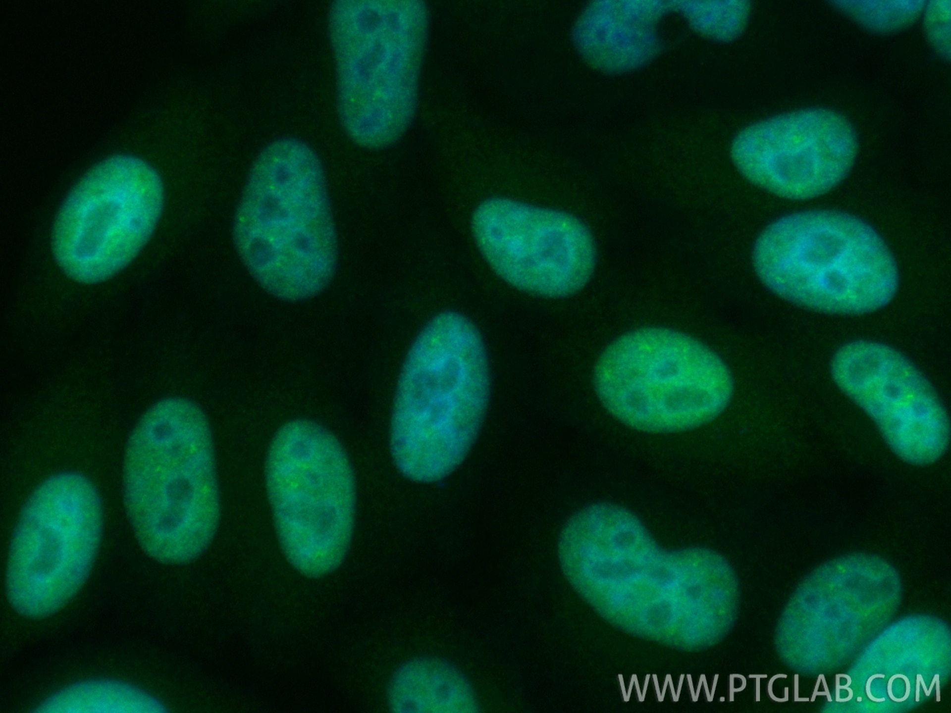 Immunofluorescence (IF) / fluorescent staining of HepG2 cells using CoraLite® Plus 488-conjugated OGFR Recombinant mon (CL488-85998)